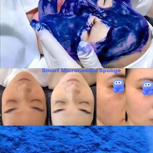 smurf microneedle sponge
